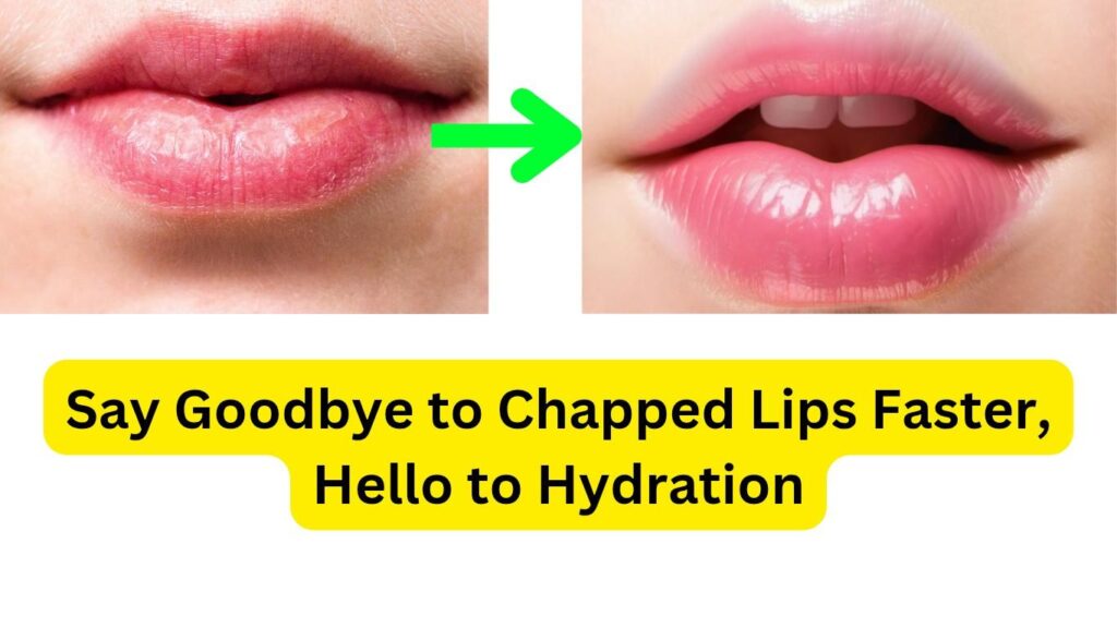 How to Heal Chapped Lips Naturally: Best Remedies for Soft & Hydrated Lips